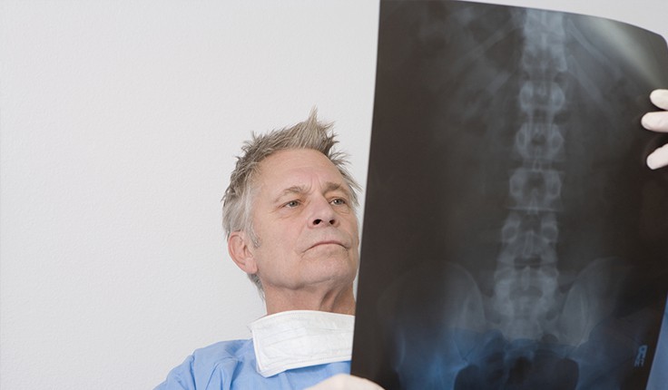 How Can Spinal Cord Stimulators Help Accident Victims? - Harris Lowry  Manton LLP